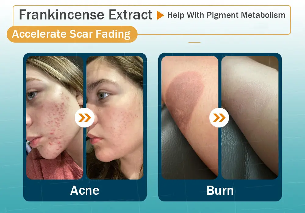 Hyaluronic Acid Nano Repair Tape - Image 18