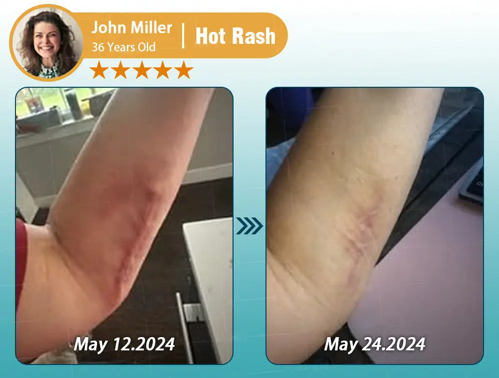 Hyaluronic Acid Nano Repair Tape - Image 19