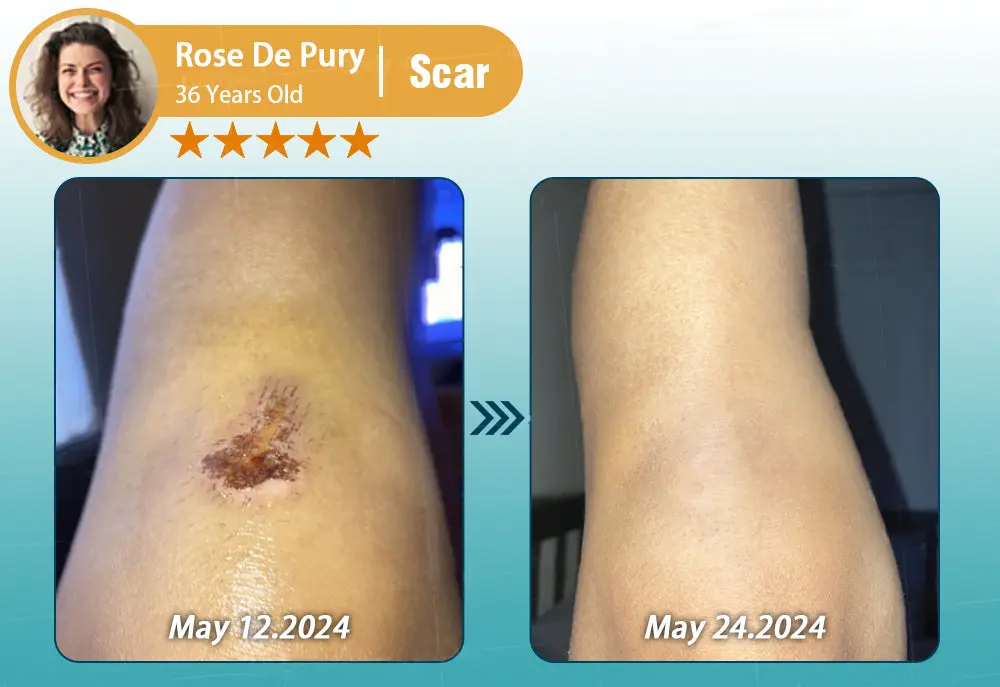 Hyaluronic Acid Nano Repair Tape - Image 22