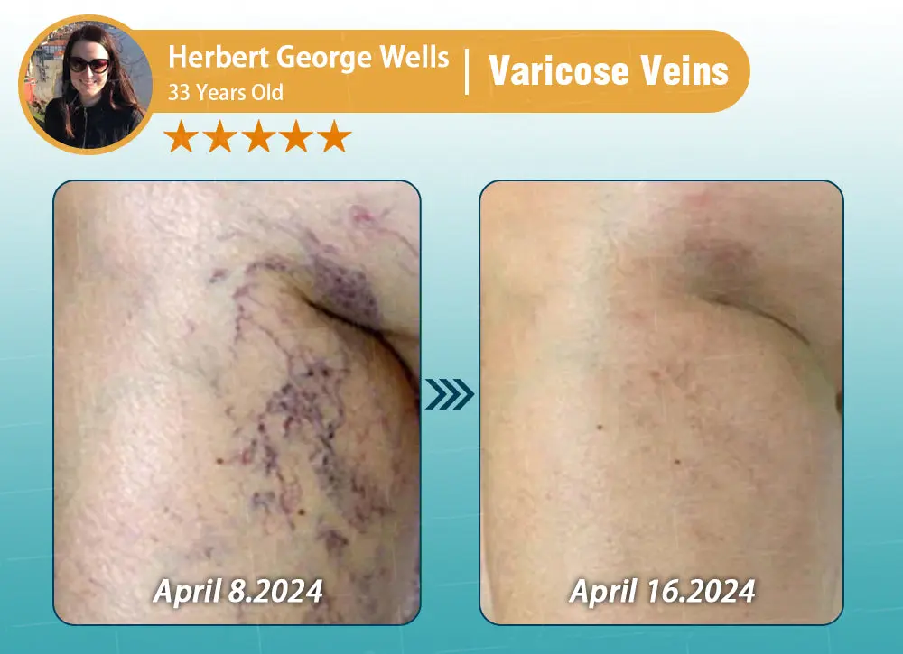 Hyaluronic Acid Nano Repair Tape - Image 23