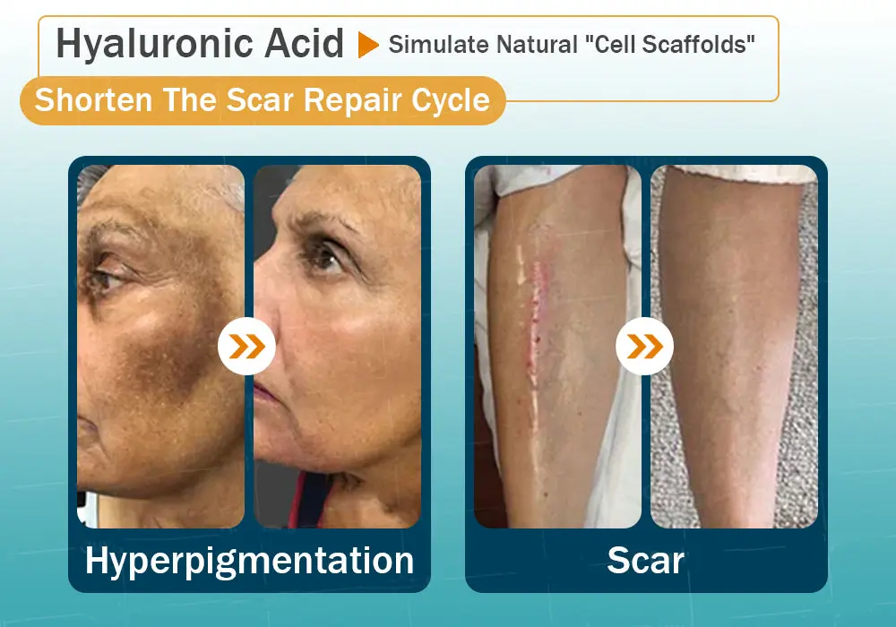 Hyaluronic Acid Nano Repair Tape - Image 24