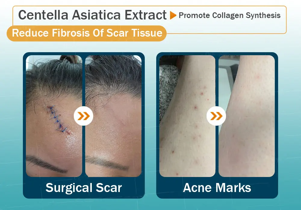 Hyaluronic Acid Nano Repair Tape - Image 25