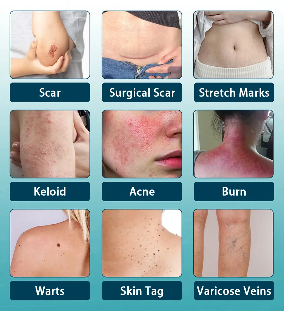 Hyaluronic Acid Nano Repair Tape - Image 28