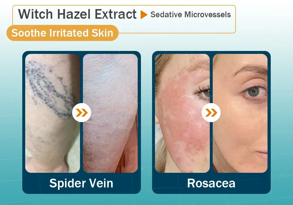 Hyaluronic Acid Nano Repair Tape - Image 7