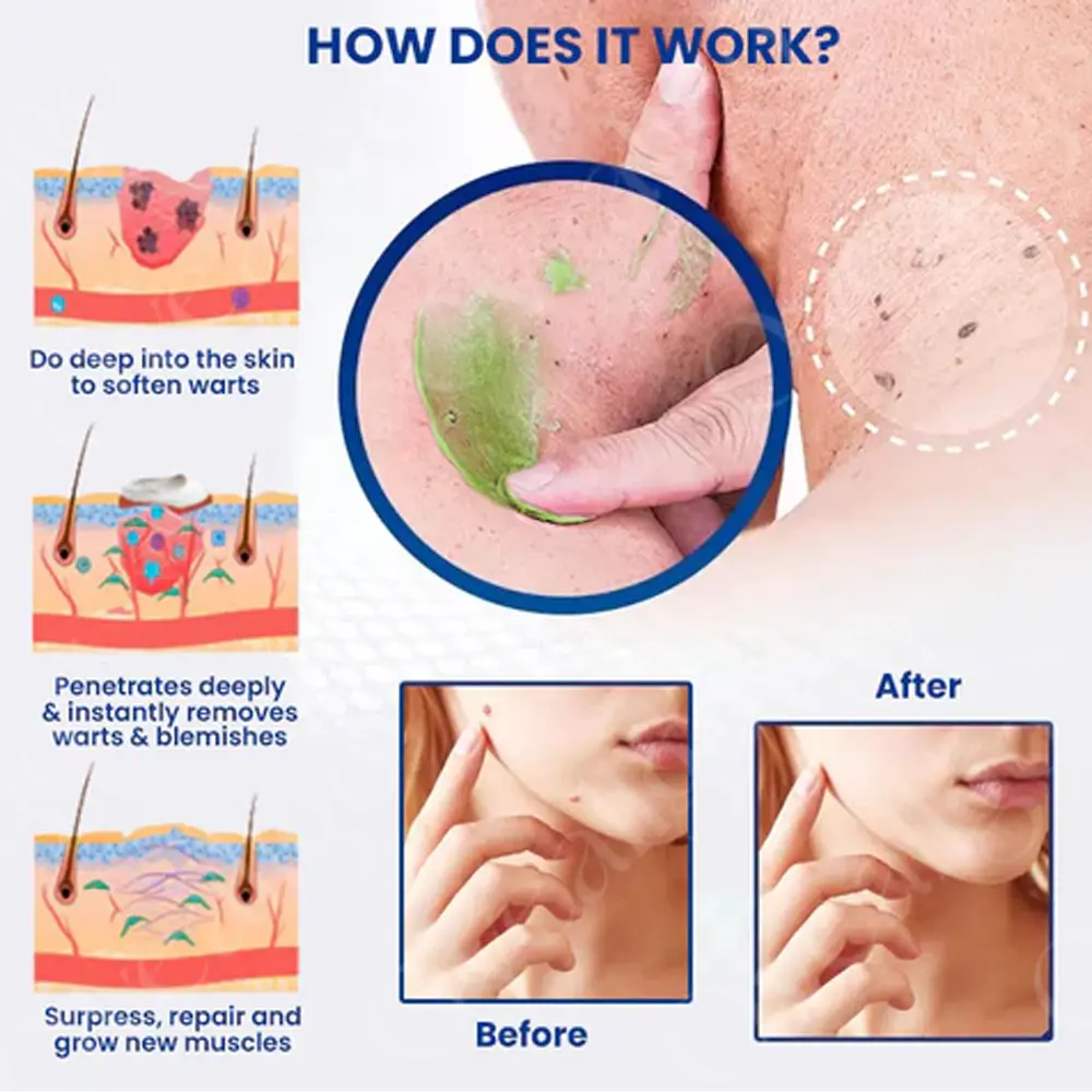 NatureErase Instant Mole & Spot Cream - Image 4