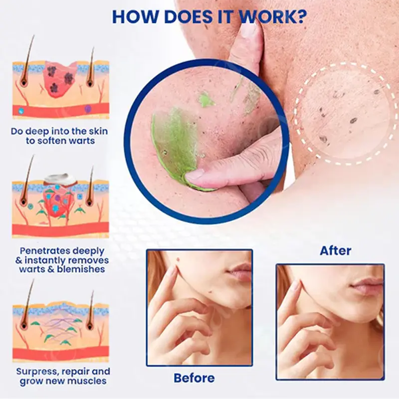 NatureErase Instant Mole & Spot Cream - Image 5
