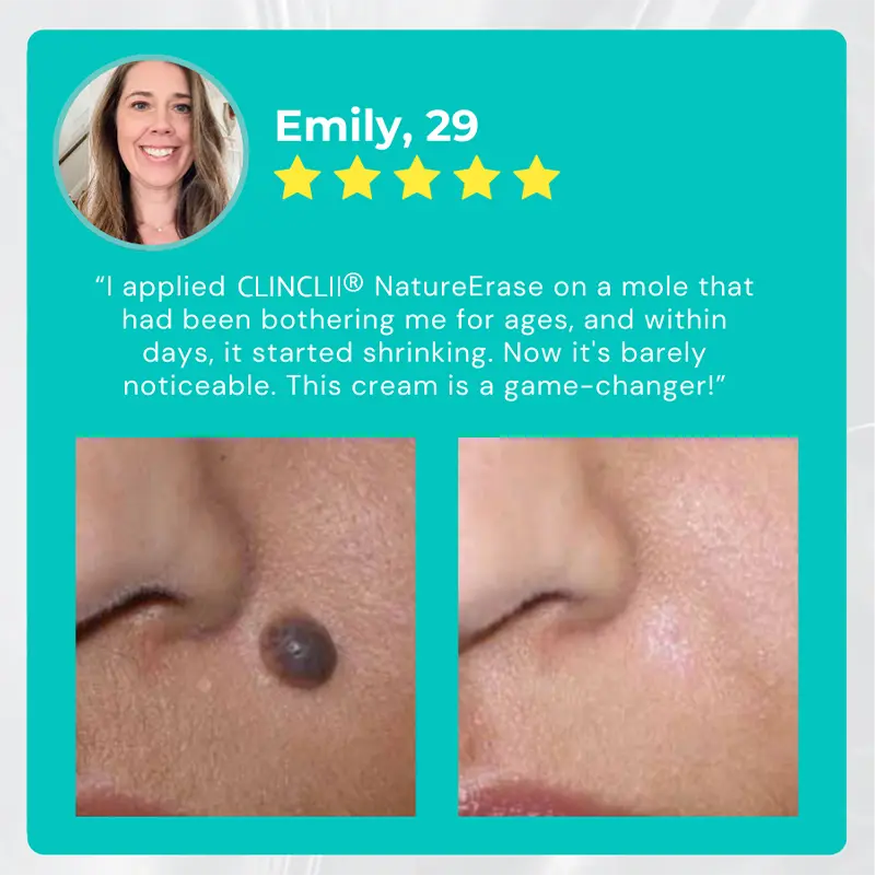 NatureErase Instant Mole & Spot Cream - Image 6