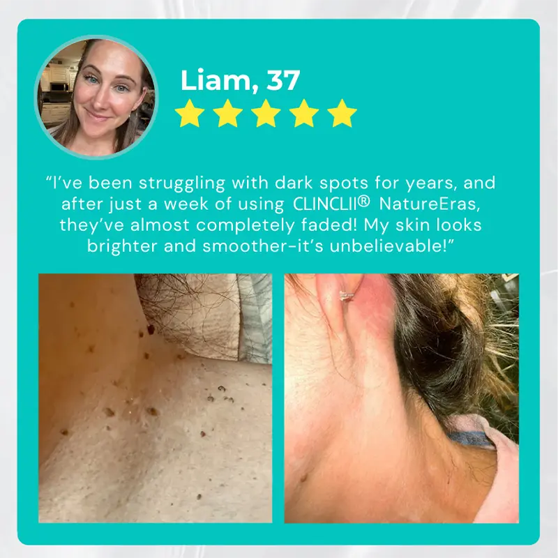 NatureErase Instant Mole & Spot Cream - Image 7