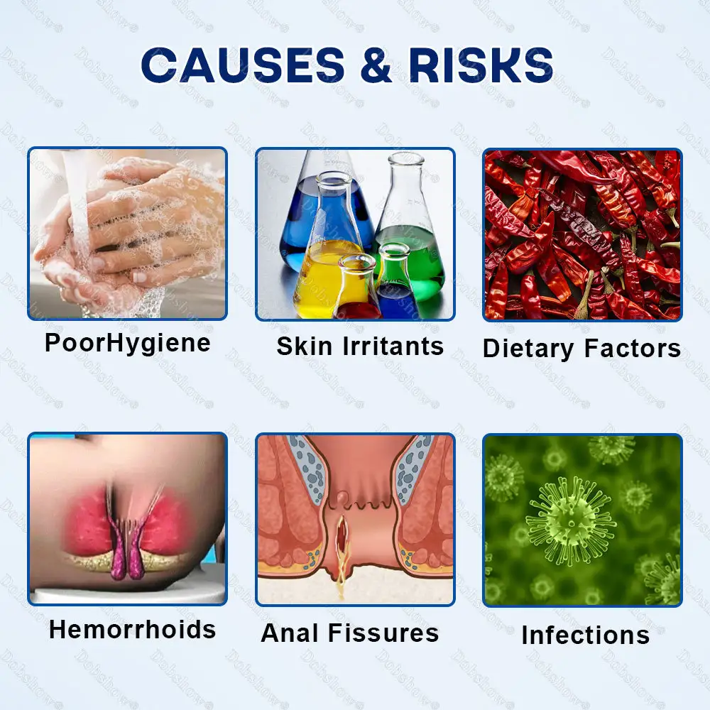 Hemorrhoid & Fissure Relief Ointment - Image 2