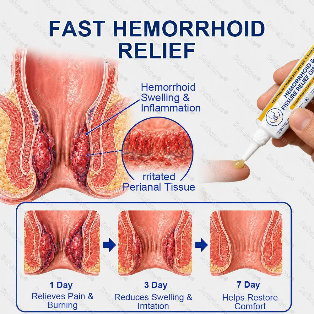 Hemorrhoid & Fissure Relief Ointment - Image 6