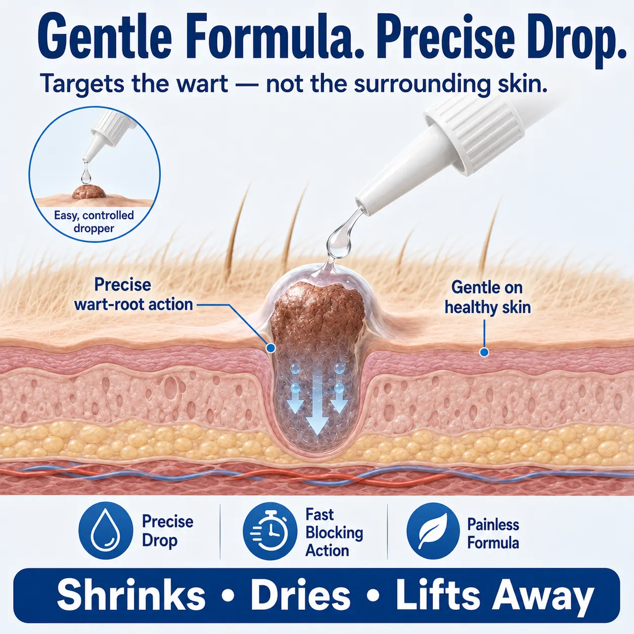 Advanced Dog Wart Remover - Image 7