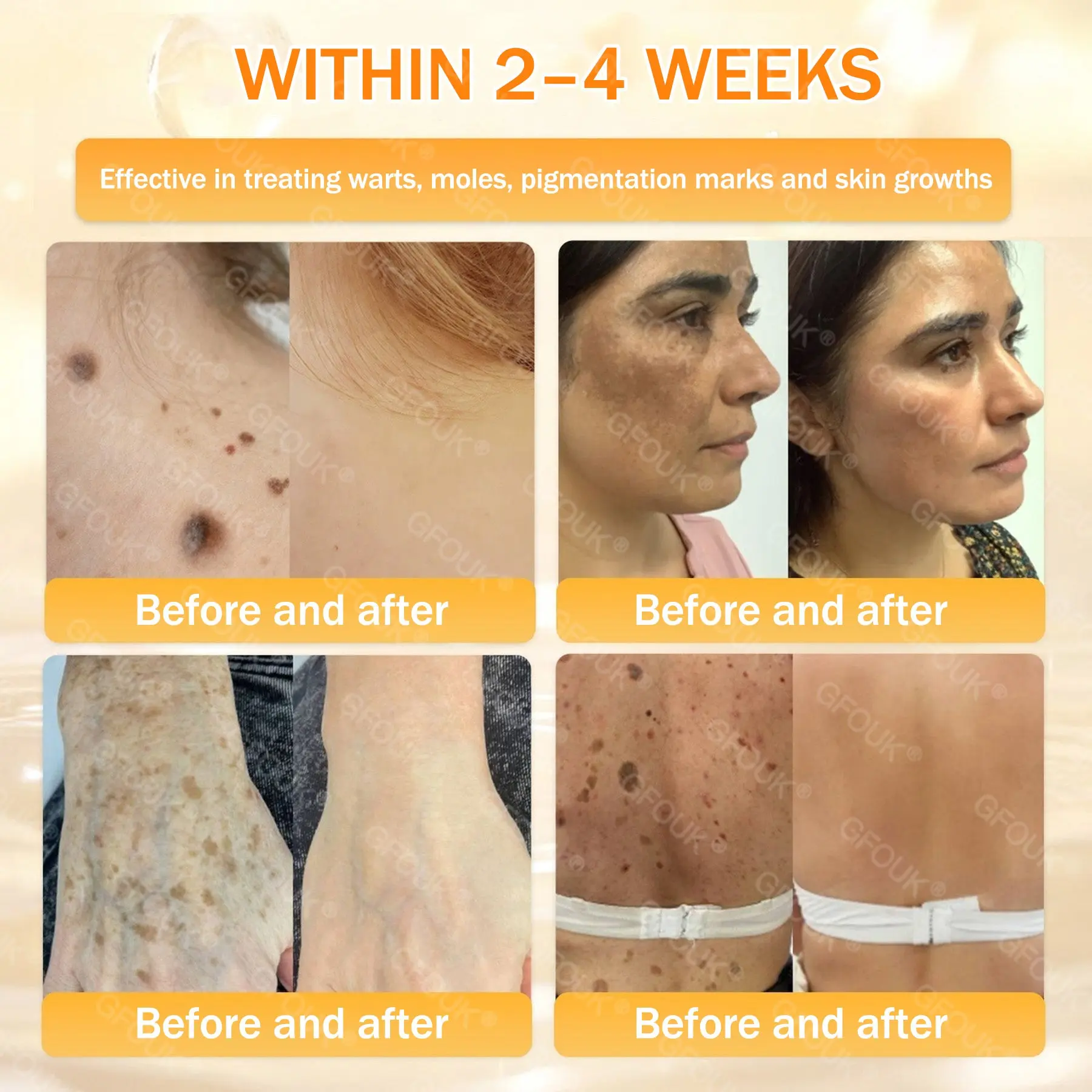 Bee Venom Skin Renewal Cream - Image 3