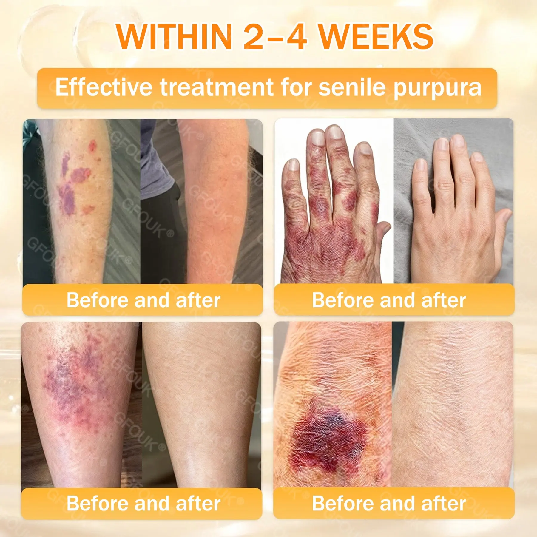 Bee Venom Skin Renewal Cream - Image 4