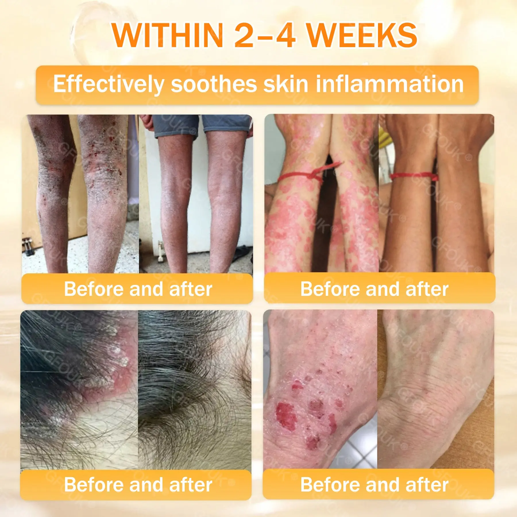 Bee Venom Skin Renewal Cream - Image 5