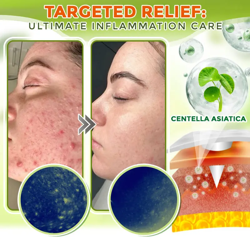 Comprehensive Microneedle Patch - Image 2