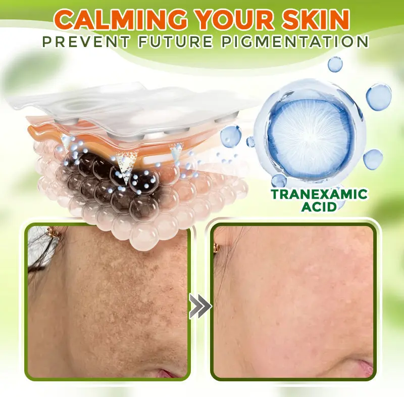 Comprehensive Microneedle Patch - Image 4