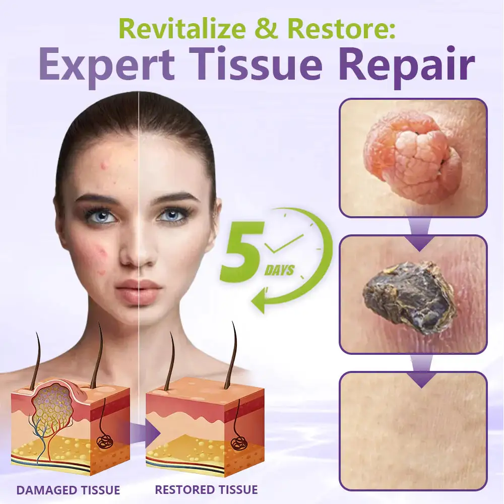 SOLUBLE BOTANICAL SKIN TAG REMOVAL PATCH - Image 2