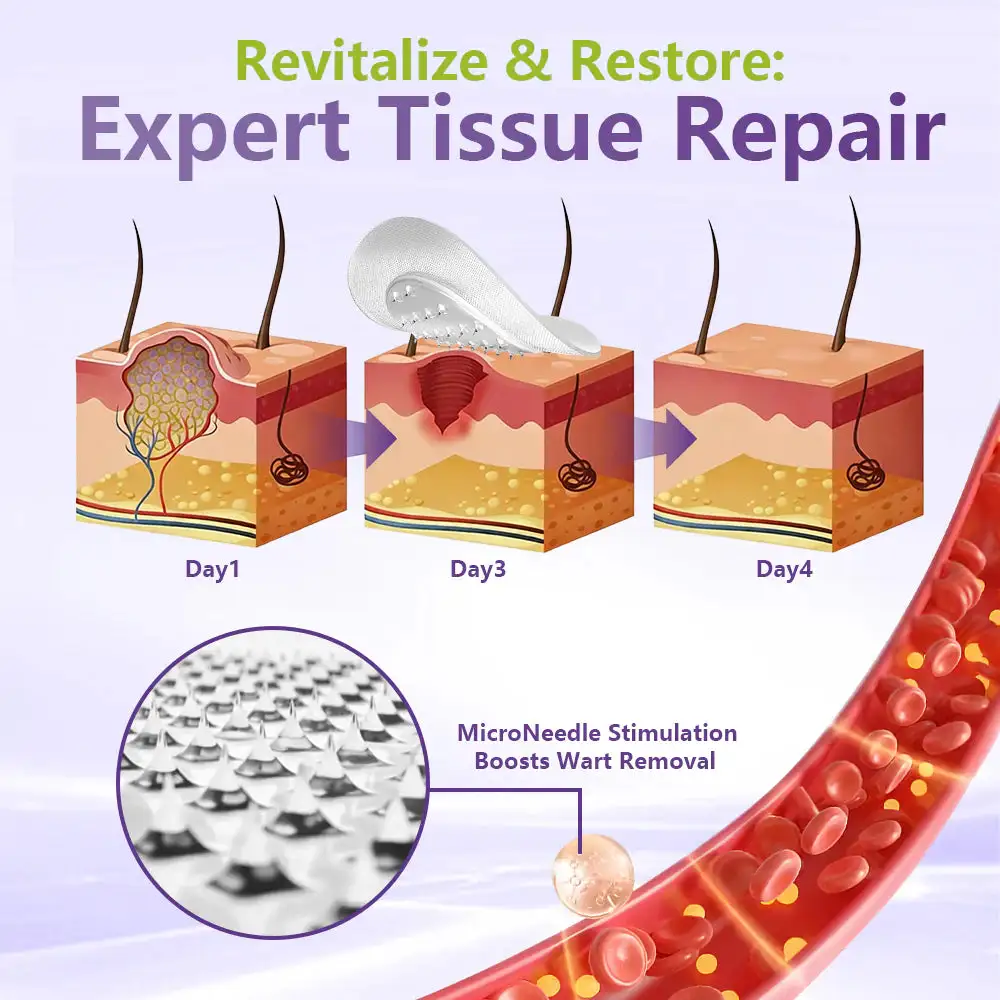 SOLUBLE BOTANICAL SKIN TAG REMOVAL PATCH - Image 4
