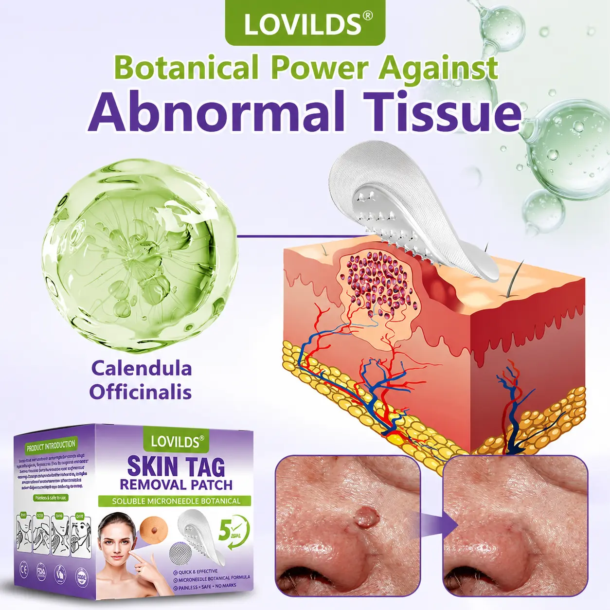 SOLUBLE BOTANICAL SKIN TAG REMOVAL PATCH - Image 6