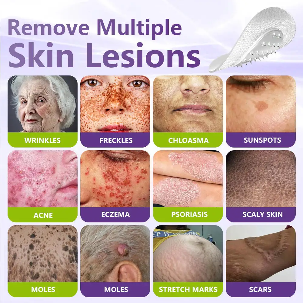 SOLUBLE BOTANICAL SKIN TAG REMOVAL PATCH - Image 7