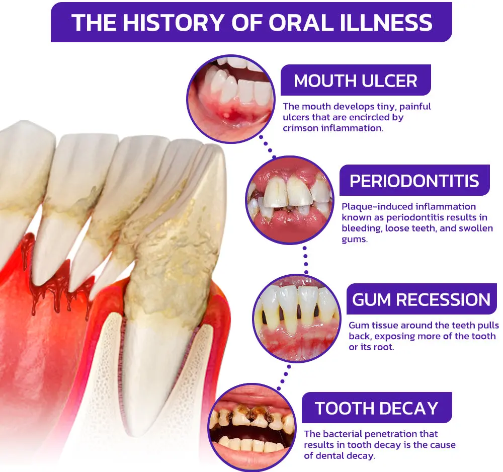 Bee Venom Dental Treatment Toothpaste - Image 2