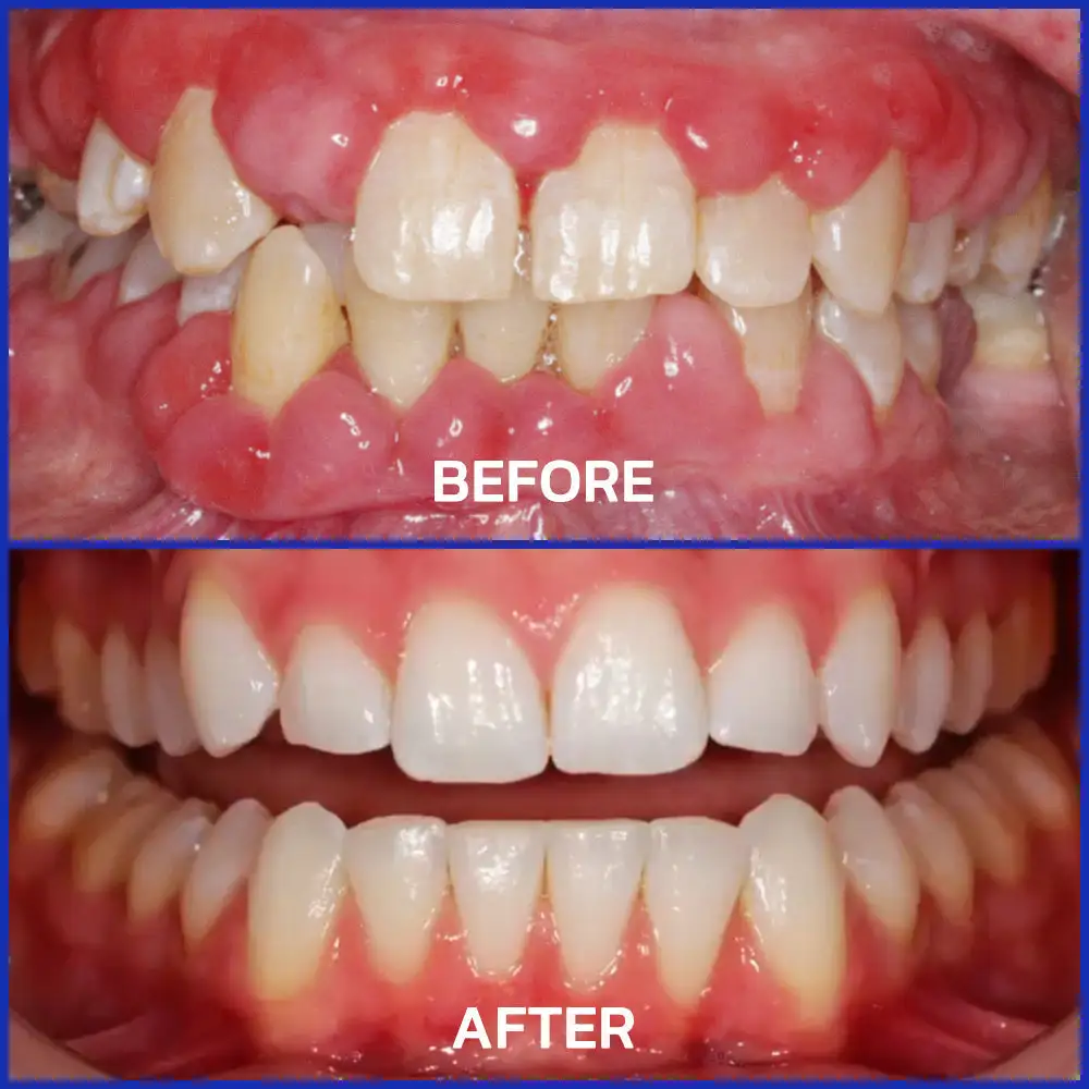 Bee Venom Dental Treatment Toothpaste - Image 5