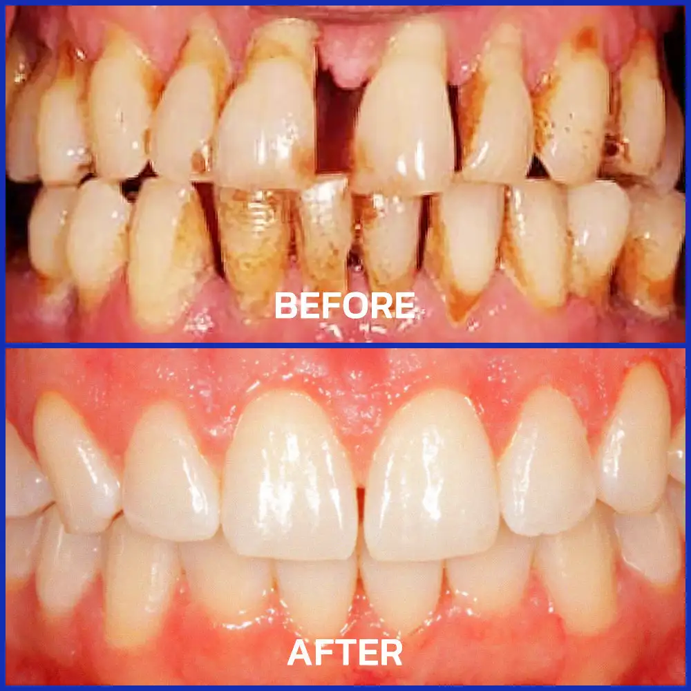 Bee Venom Dental Treatment Toothpaste - Image 6