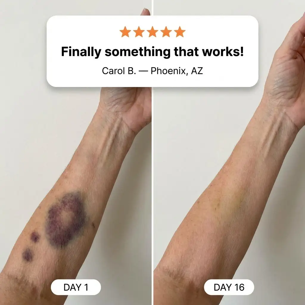 Bruise Repair & Skin-Strengthening Cream - Image 2