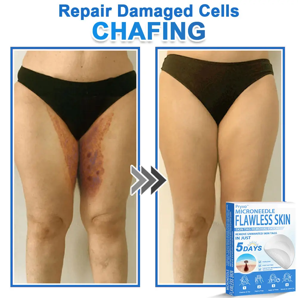 2-in-1 & Hydrocolloid Patch - Image 12