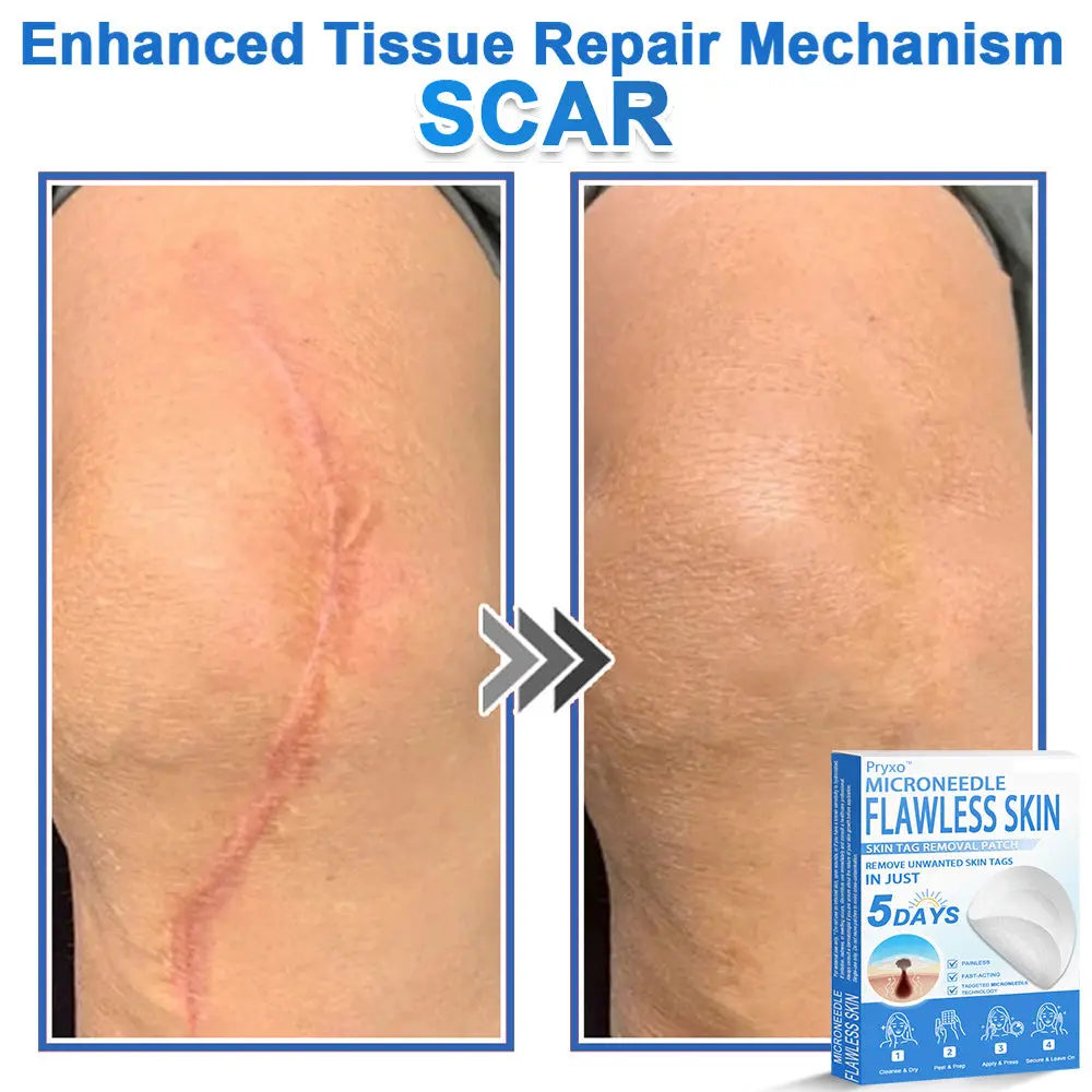 2-in-1 & Hydrocolloid Patch - Image 13