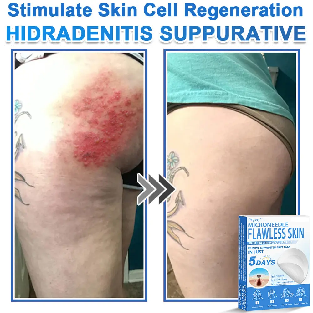2-in-1 & Hydrocolloid Patch - Image 14
