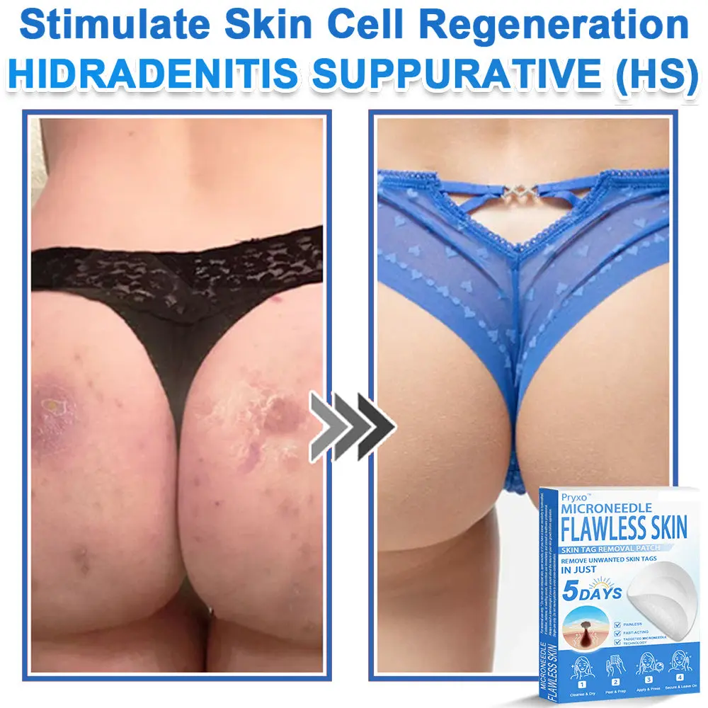 2-in-1 & Hydrocolloid Patch - Image 15