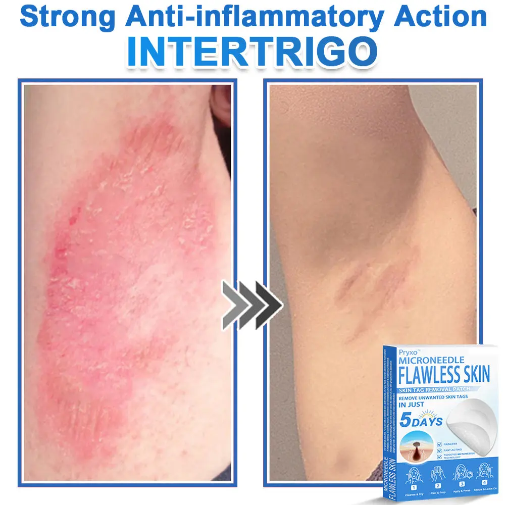 2-in-1 & Hydrocolloid Patch - Image 16