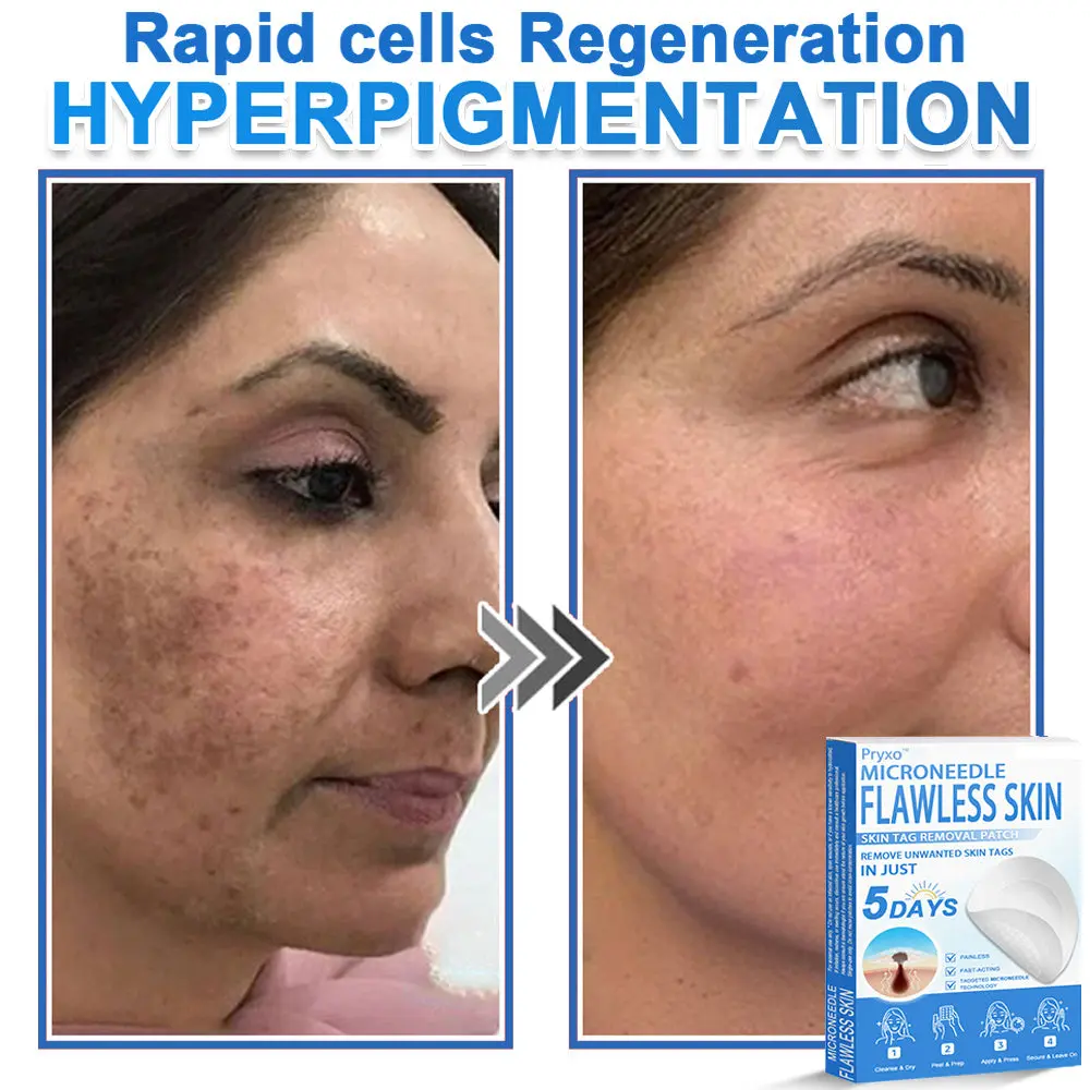 2-in-1 & Hydrocolloid Patch - Image 17