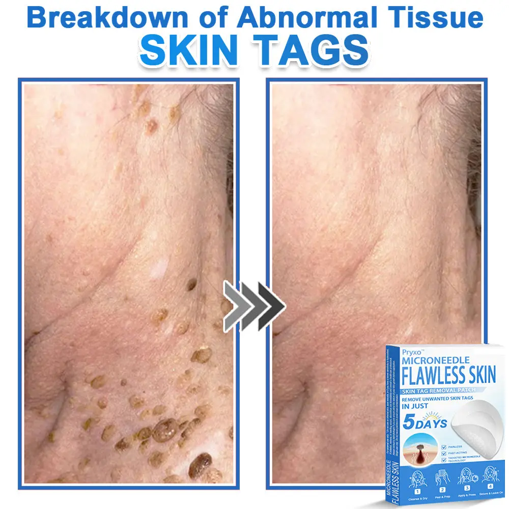 2-in-1 & Hydrocolloid Patch - Image 18