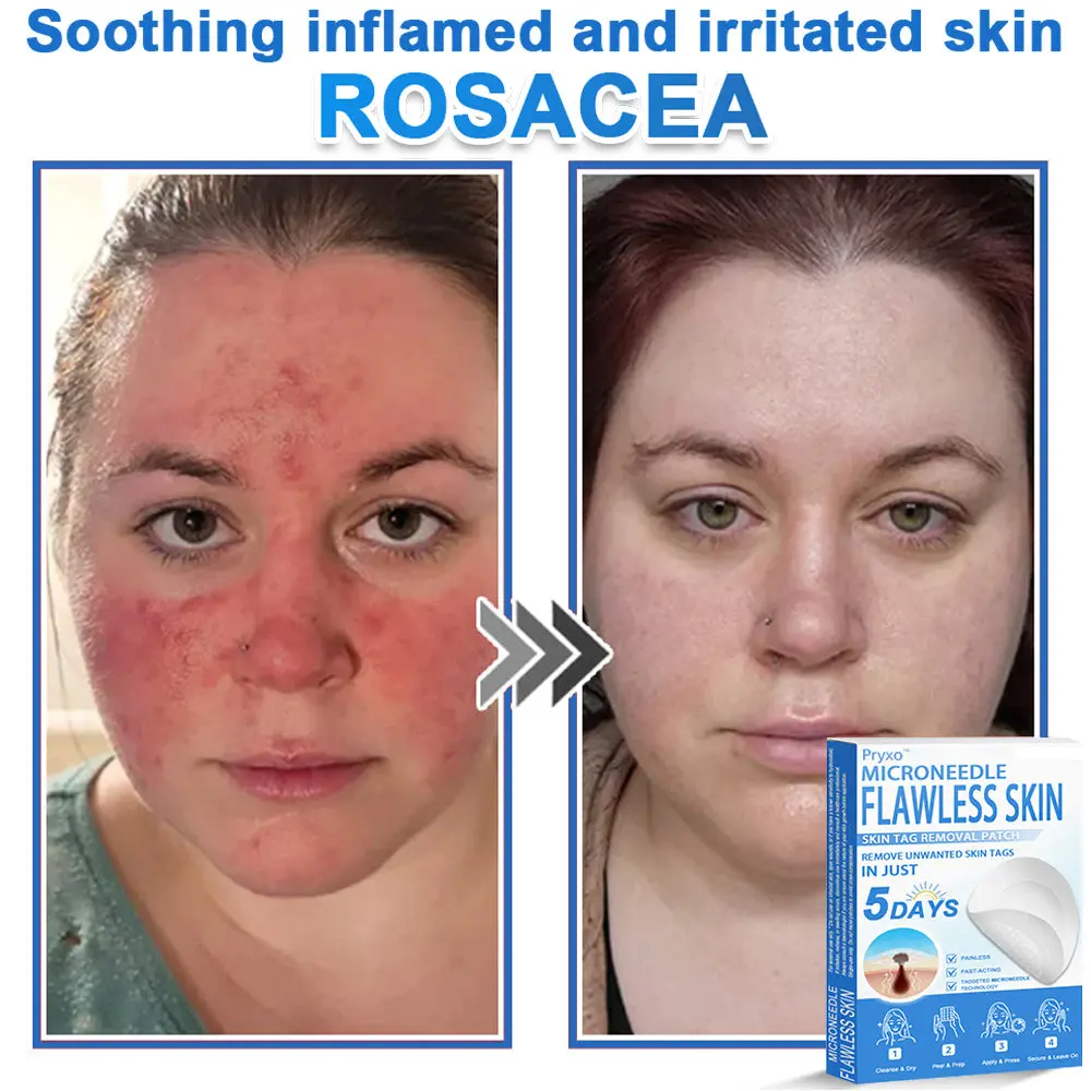 2-in-1 & Hydrocolloid Patch - Image 19