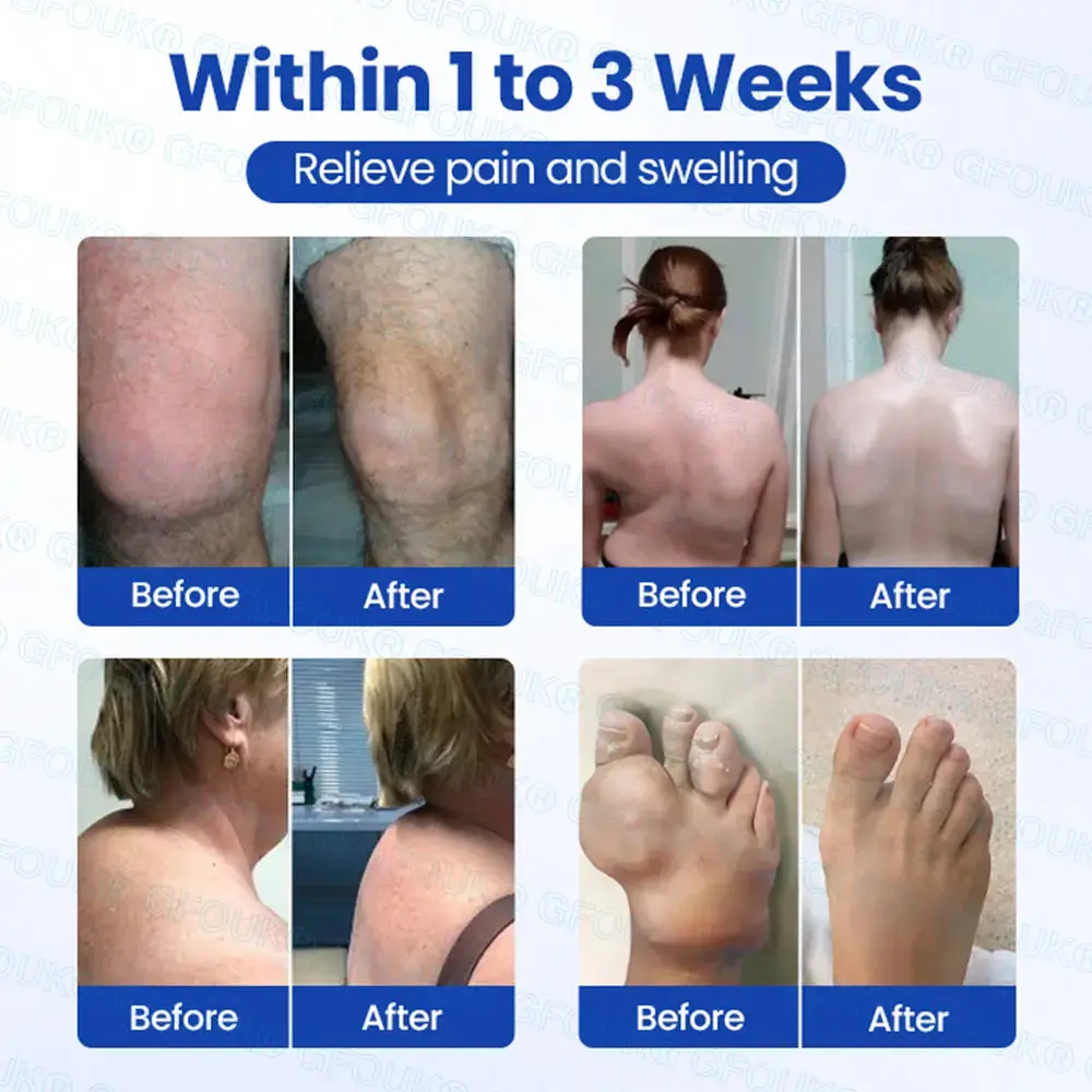 Instant Relief Arthritis Gel - Image 4