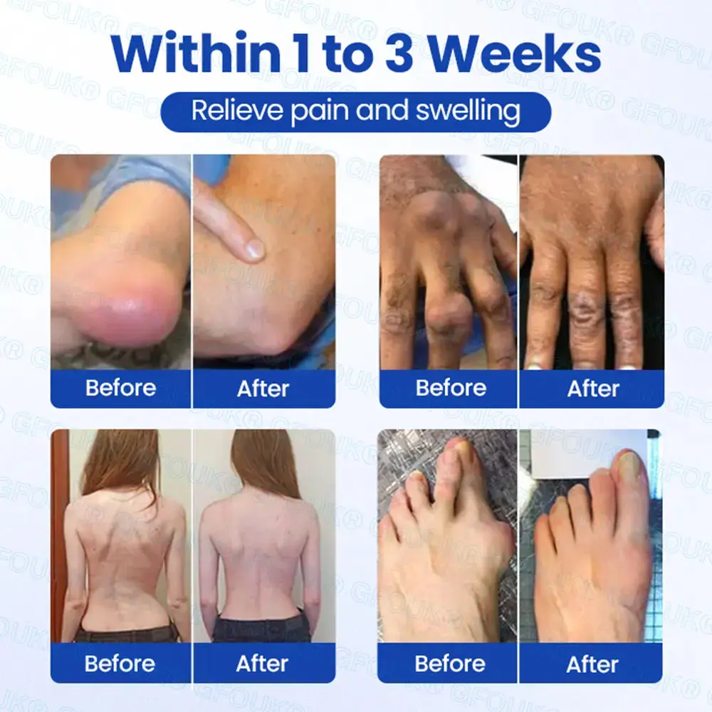 Instant Relief Arthritis Gel - Image 8