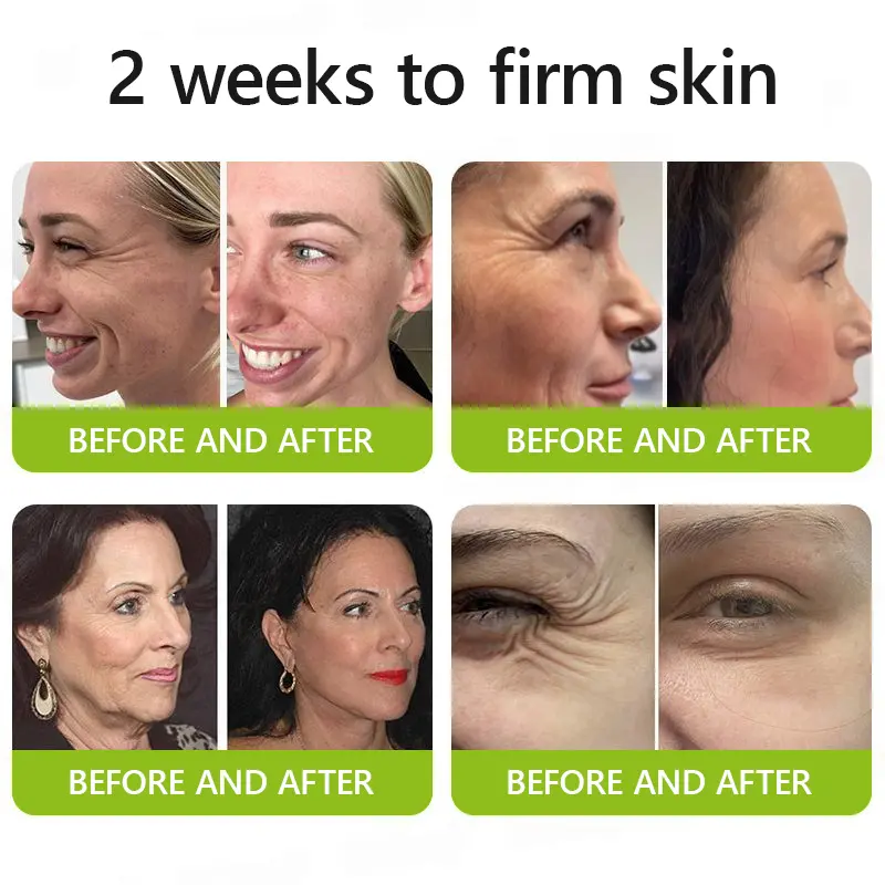 BOTOX & VITA A RETINOL SHOT Wrinkle Lift Tightening Cream - Image 5