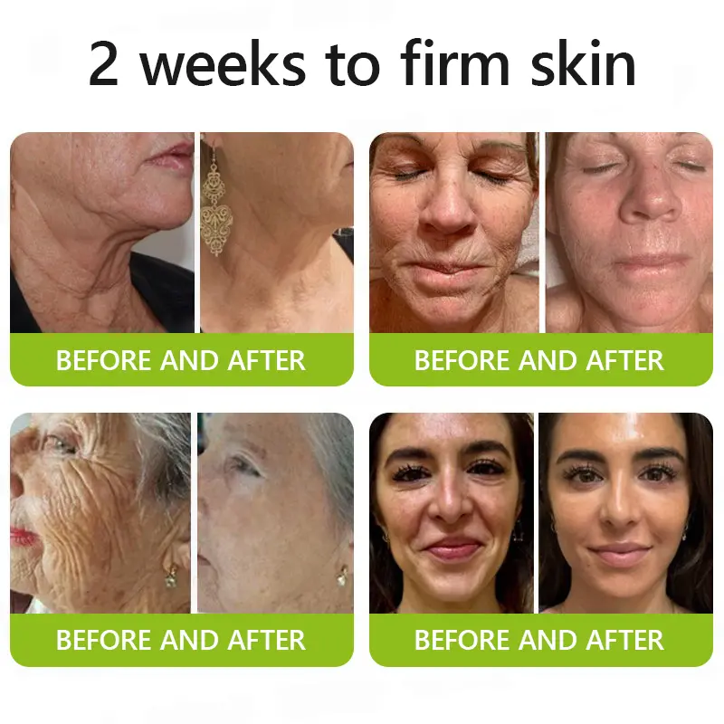 BOTOX & VITA A RETINOL SHOT Wrinkle Lift Tightening Cream - Image 7