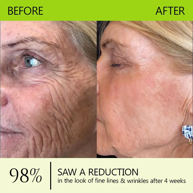 BOTOX & VITA A RETINOL SHOT Wrinkle Lift Tightening Cream - Image 9