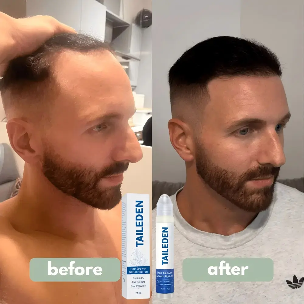TAILEDEN Pro-Growth Roll-On Hair Growth Serum - Image 15