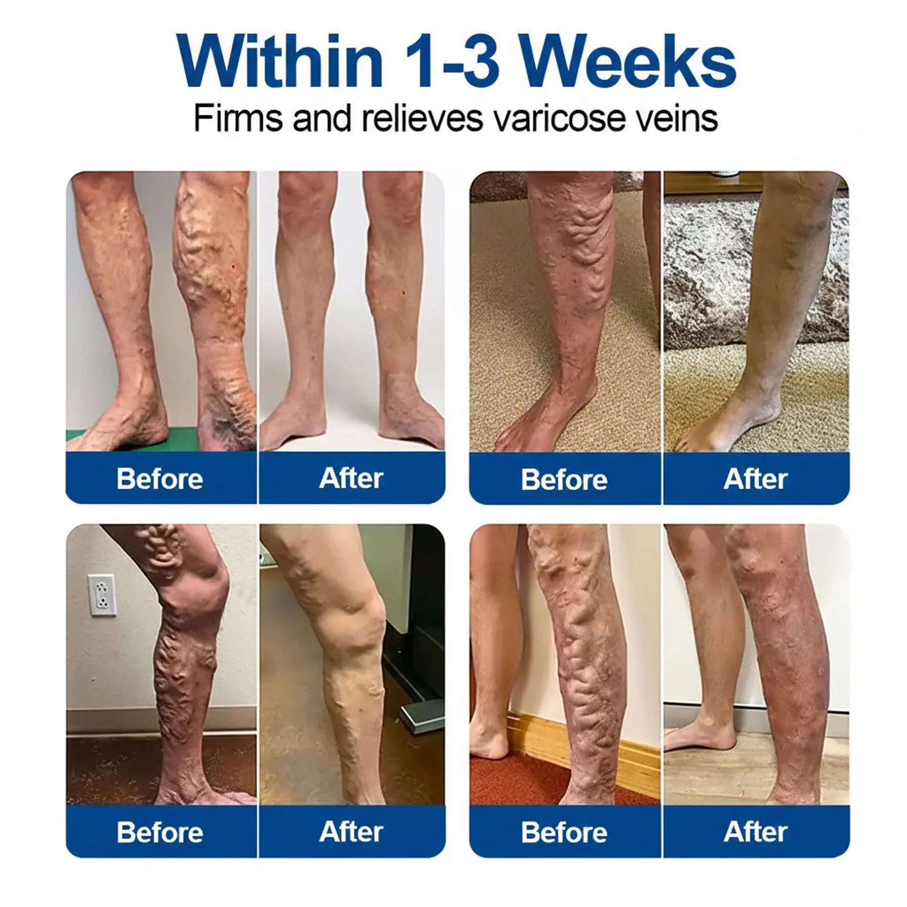 VeinEase Care Patch - Image 3