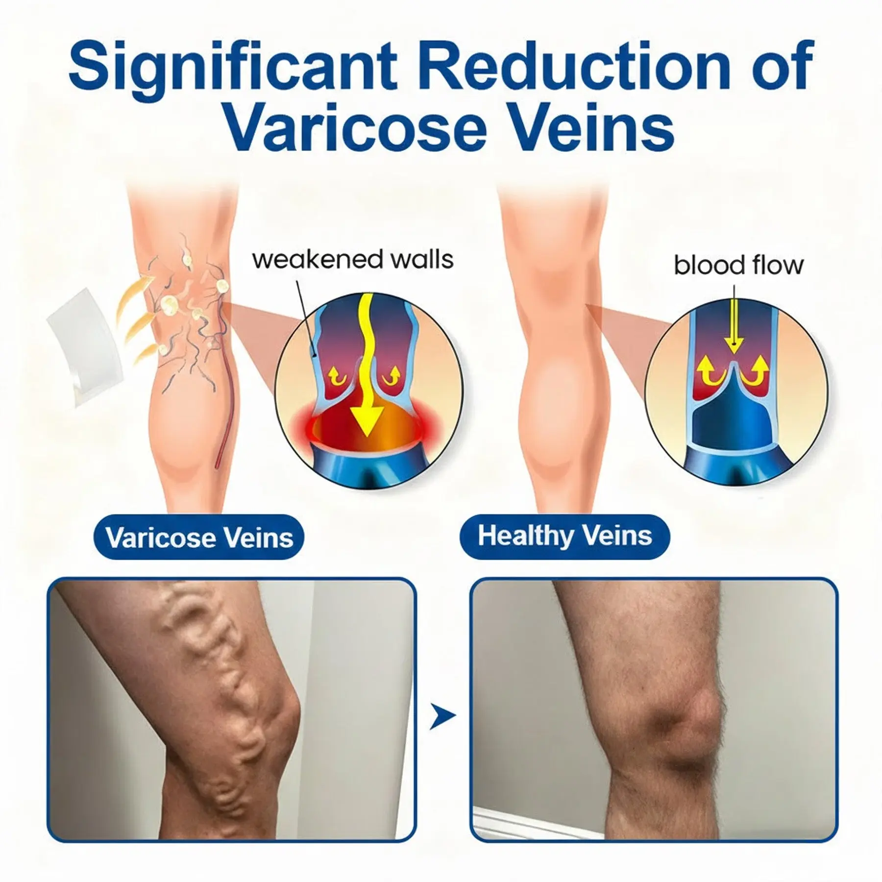 VeinEase Care PatchInstant Relief, Long-Term Results - Image 4