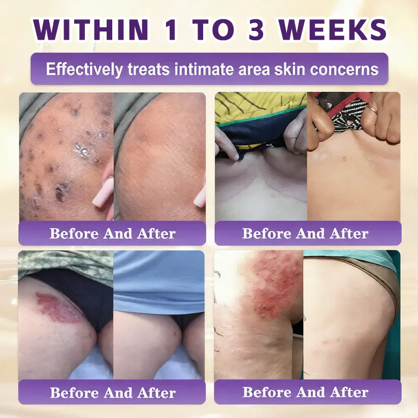 Biotin 10-in-1 Skin Restoration Cream - Image 2