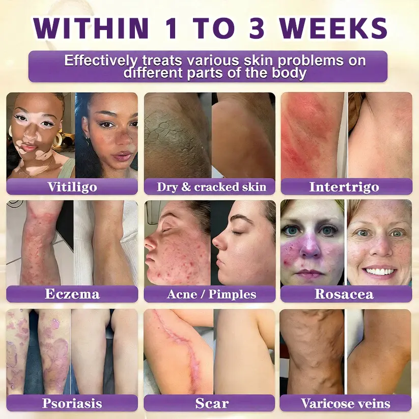 Biotin 10-in-1 Skin Restoration Cream - Image 3