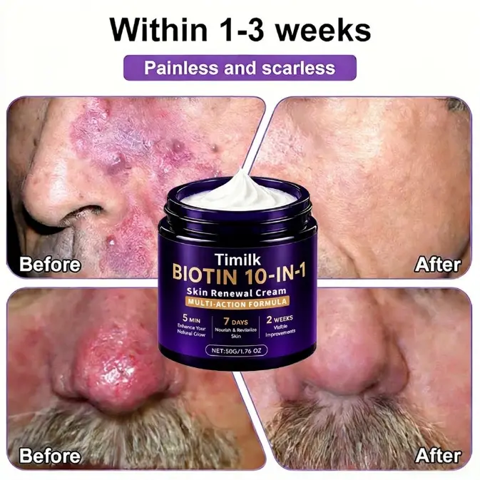 Biotin 10-in-1 Skin Restoration Cream - Image 7