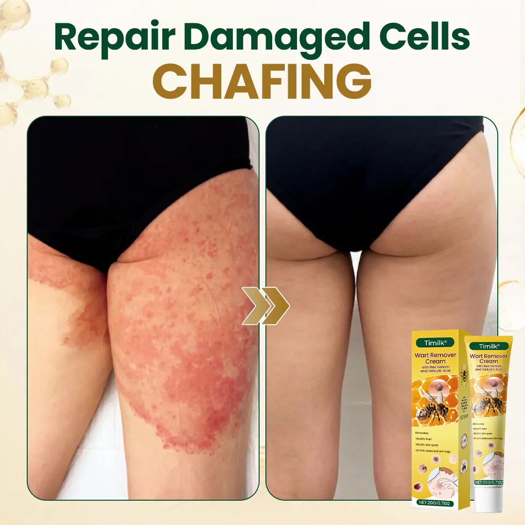 Wart Remover Cream - Image 10