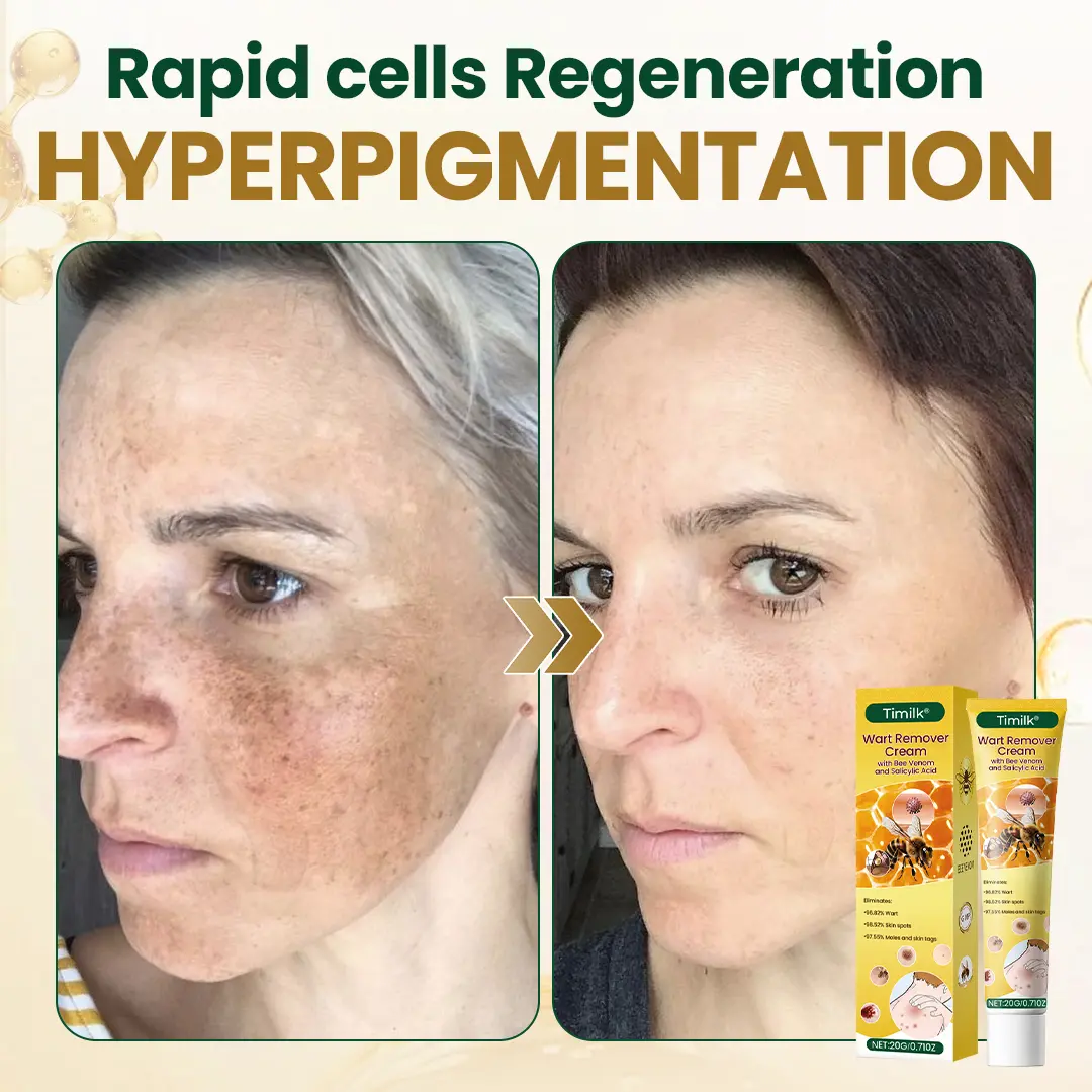 Wart Remover Cream - Image 6