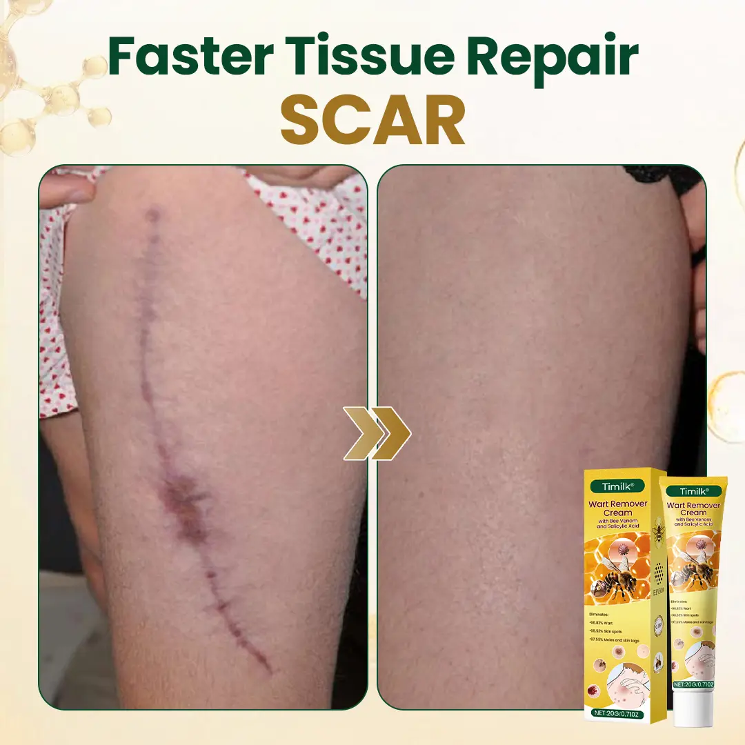 Wart Remover Cream - Image 9